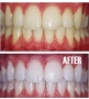 Teeth Whitening Cardiff, opening hours