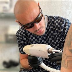 Skin Fade - Laser Tattoo Removal Specialists, Blackwater opening hours